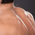 Relief therapy for shoulder pain