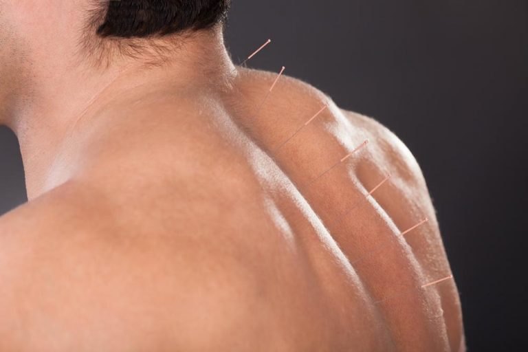 Relief therapy for shoulder pain